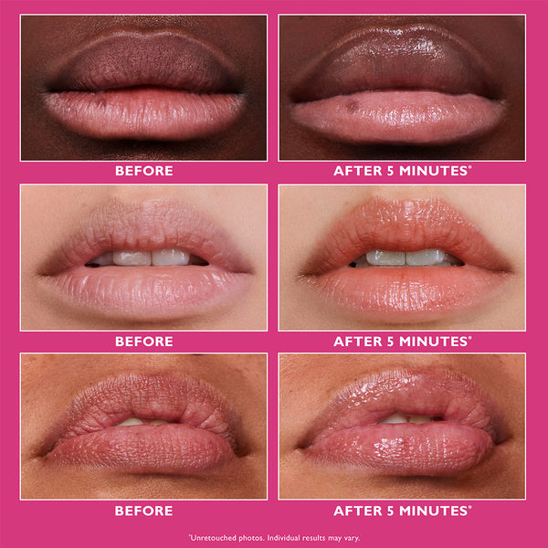 Peter Thomas Roth Instant FIRMx Lip Filler