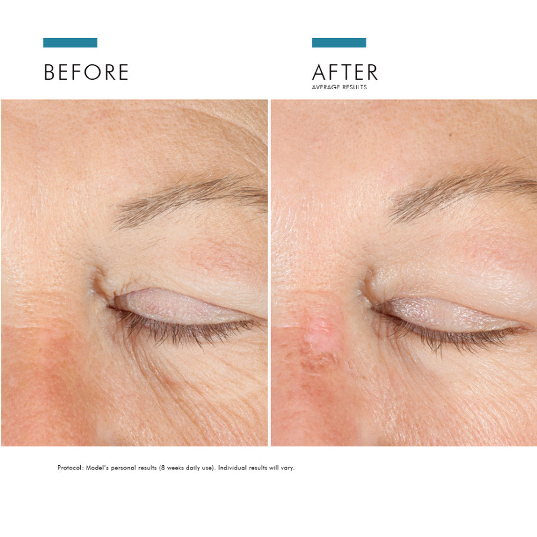 Skinceuticals age deals eye complex