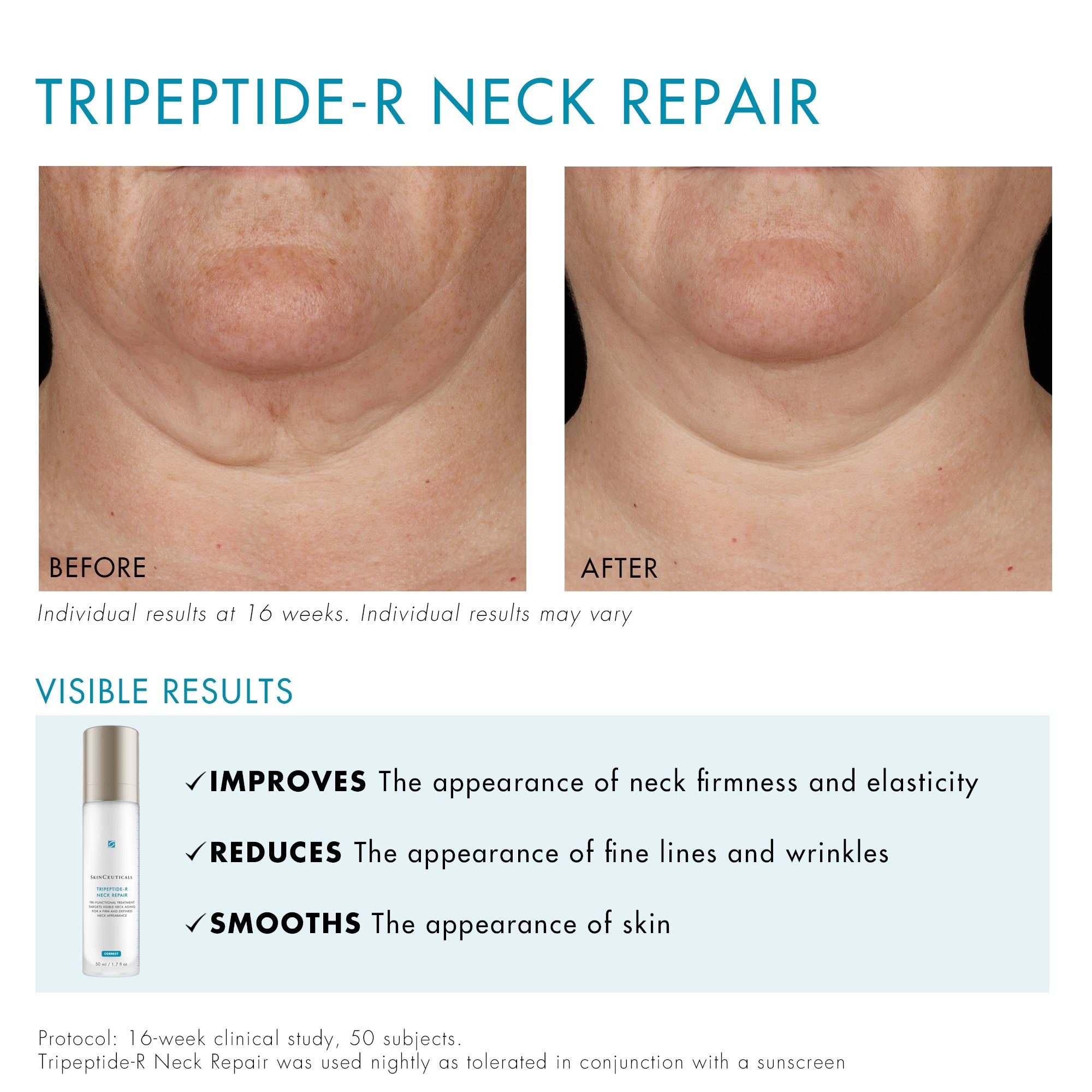 SkinCeuticals Tripeptide-R offers Neck Repair 50ml new W/O box